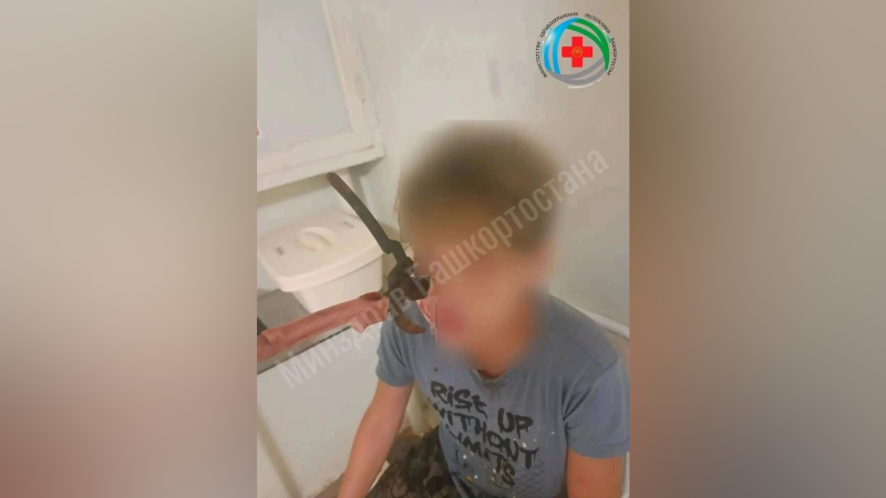 Садовый секатор в щеке подростка в Башкирии